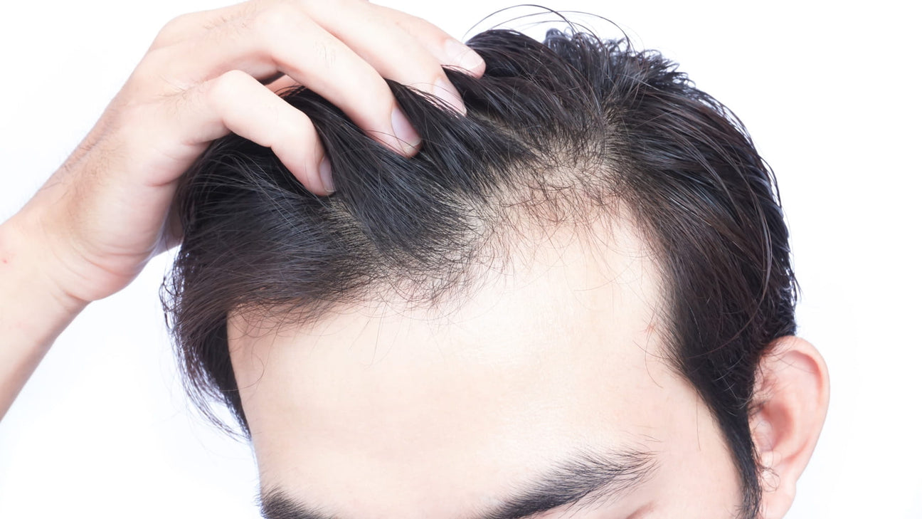What is DTH and how is it responsible for hair loss?